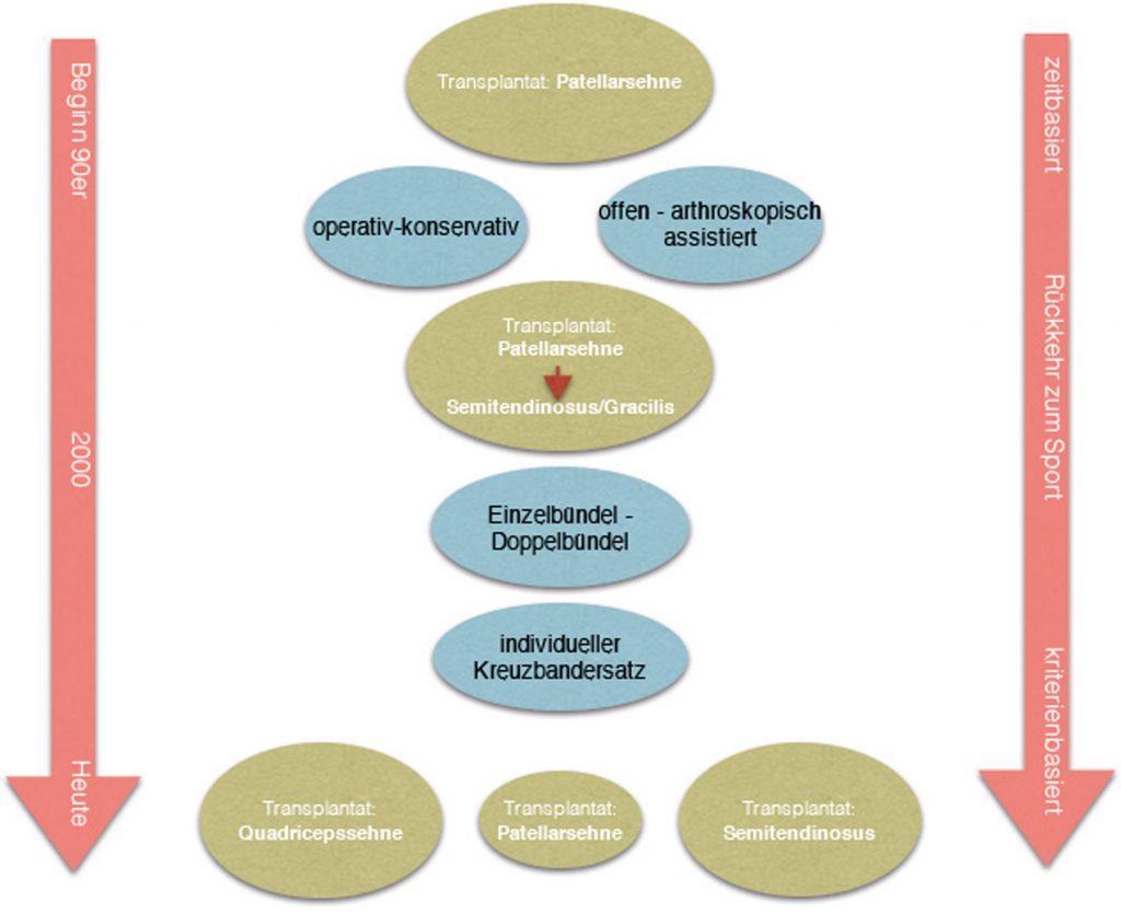 25 Jahre Evolution bei der Behandlung der vorderen Kreuzband­ruptur