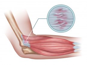 Die genaue Analyse der auslösenden Faktoren ist entscheidend für die Therapieplanung