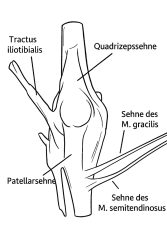 Unterschiedliche Möglichkeit der Transplantatentnahme für VKB